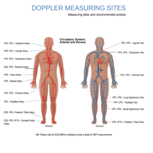 Doppler Huntleigh + vp8 probe 1