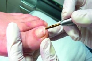 opbergdoos (leeg) voor Steri Maxi Safe 1